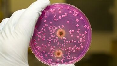 Pathologische Entladung bei Männern, wenn er aufgeregt ist